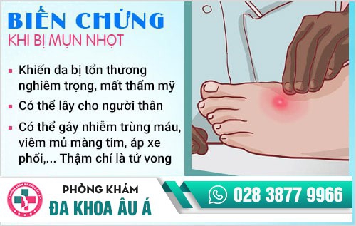 mụn nhọt