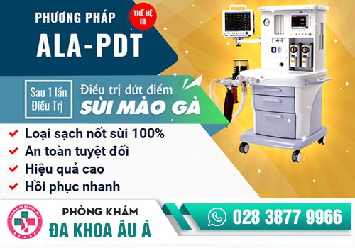 Các phương pháp điều trị sùi mào gà hiệu quả nhất
