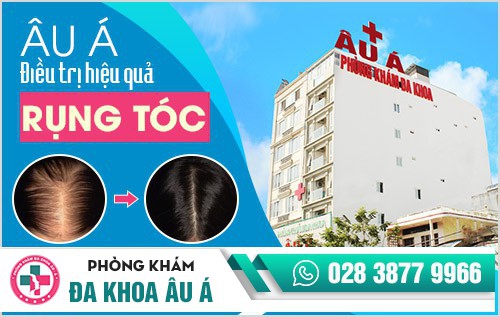 Cách chữa rụng tóc hiệu quả tại Phòng Khám Da Liễu Âu Á