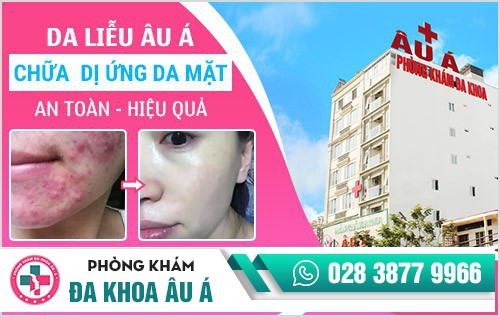 Dị ứng da mặt