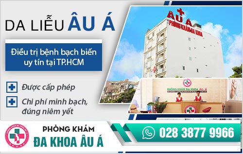 khám bạch biến