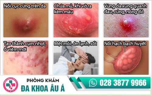 mụn nhọt