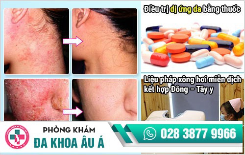 dị ứng da