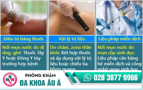 nổi mụn nước