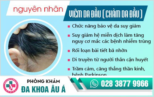 viêm da đầu