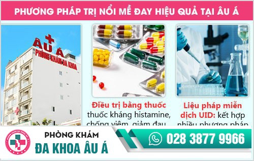 Nổi mề đay