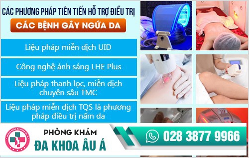 bệnh bạch biến