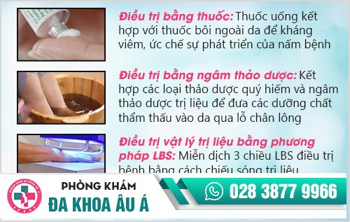 Địa chỉ điều trị lang ben tốt nhất tại TP.HCM