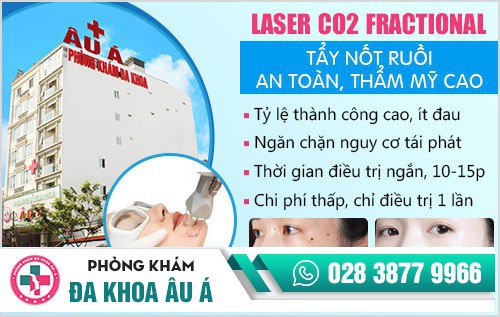 Có nên tẩy nốt ruồi ở bệnh viện da liễu TP.HCM