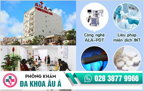 Nổi mụn quanh miệng