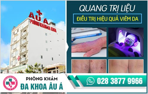 viêm da cơ địa