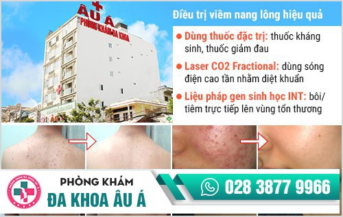 viêm nang lông