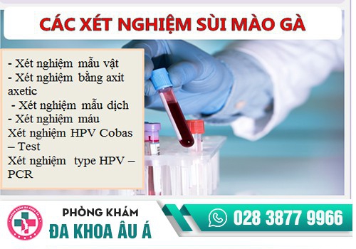test sùi mào gà