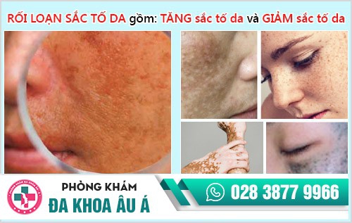 cách trị rối loạn sắc tố da