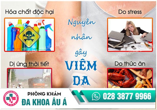 Viêm da: Triệu chứng, nguyên nhân và chẩn đoán điều trị